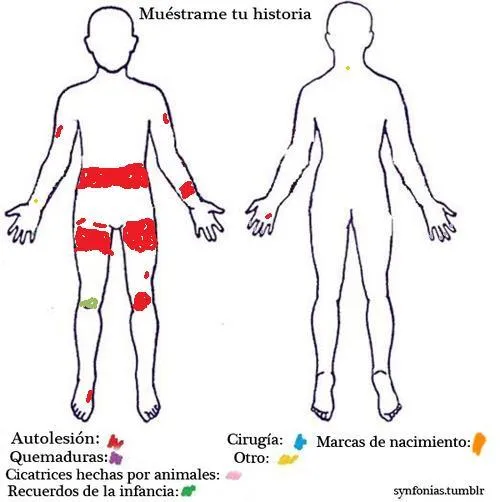 Solo te cortabas en las piernas después de todo eso? |  ask.fmhttps://ask.fm/EstareAquiParaTi