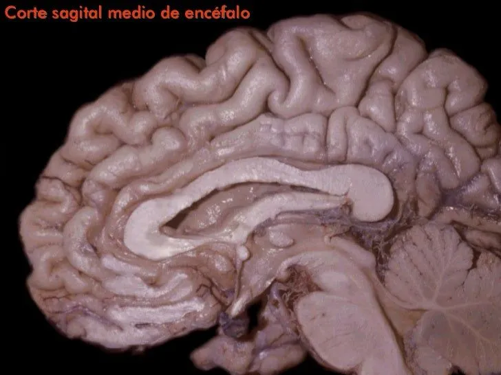 cortes-cerebro-2-728.jpg?cb= ...
