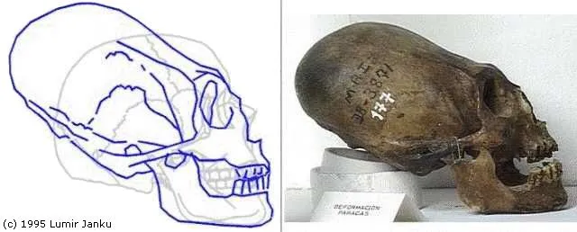 Cráneos Deformados (recomendado) - Taringa!