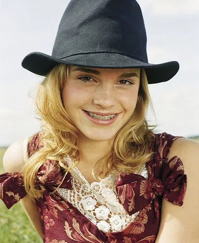 Crαzy News♥: SOS: TENGO BRACKETS! CONSEJOS PARA SOPORTARLOS Crαzy News♥: SOS: TENGO BRACKETS! CONSEJOS PARA SOPORTARLOS