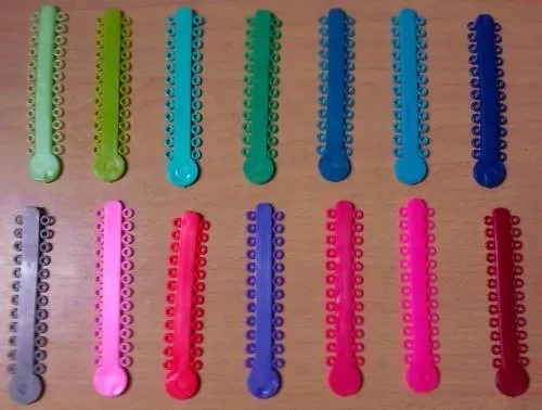 Cuida tu sonrisa metalica » Blog Archive » ¿Cómo elegir el color ... Cuida tu sonrisa metalica » Blog Archive » ¿Cómo elegir el color ...