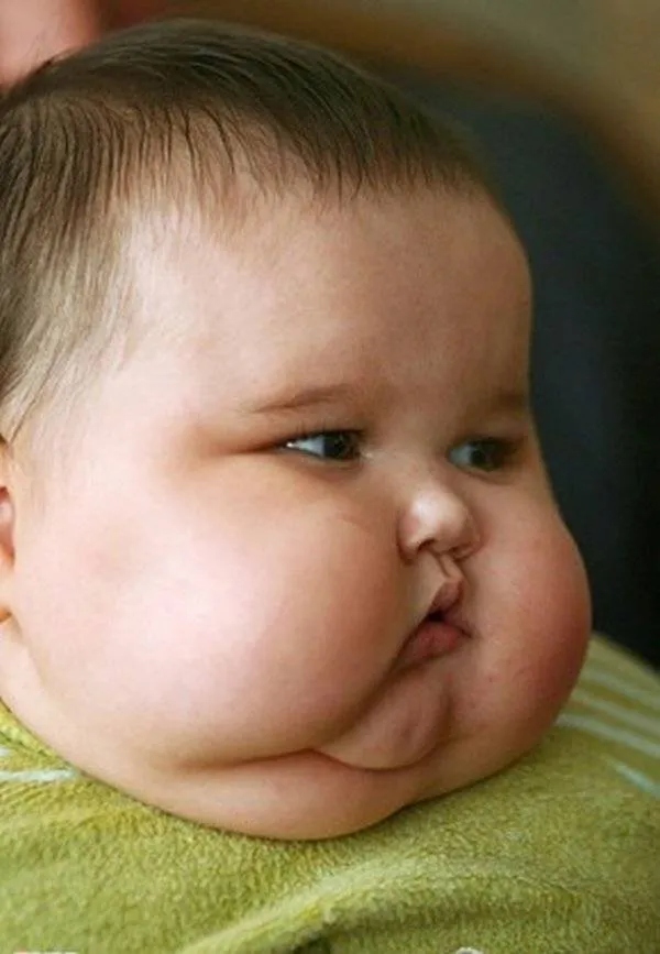 El curioso casao de un bebé de 20 Kg – Marcianos El curioso casao de un bebé de 20 Kg – Marcianos