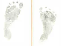 ... le hacen a tu bebé luego de nacer - Foro de bebes y madres - Pekebebe ... le hacen a tu bebé luego de nacer - Foro de bebes y madres - Pekebebe