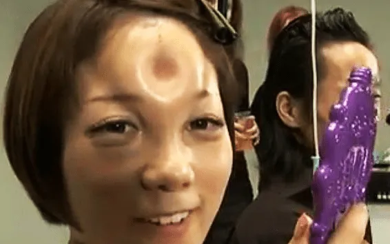 Deformación del rostro con bultos circulares, una moda en Japón (+ ... Deformación del rostro con bultos circulares, una moda en Japón (+ ...