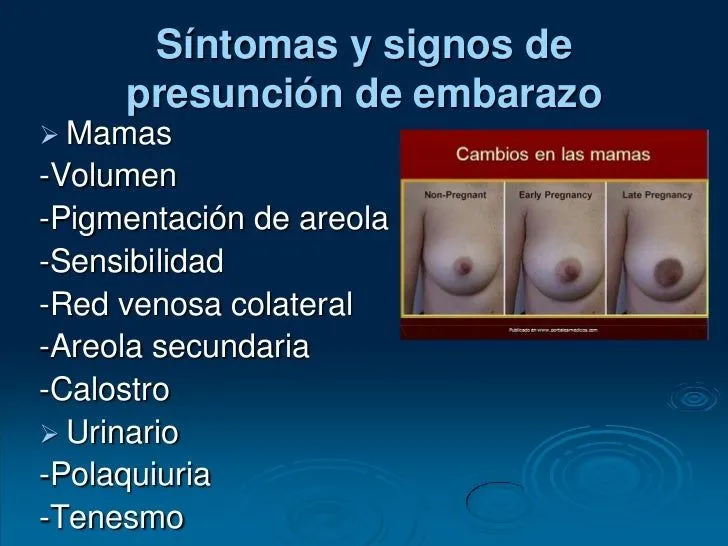 diagnostico-de-embarazo-sandy- ...