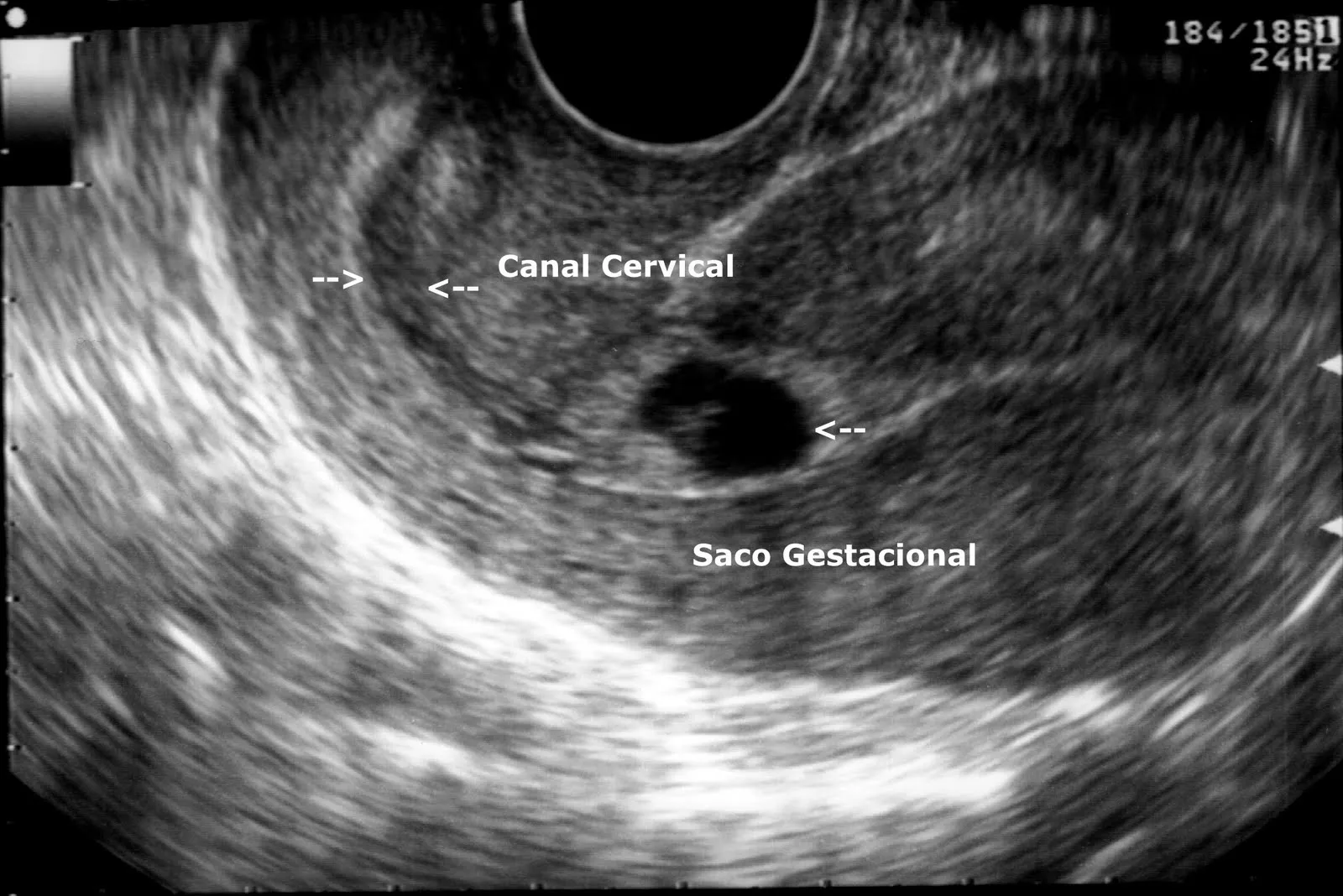 Diario de un Medico II: mayo 2011