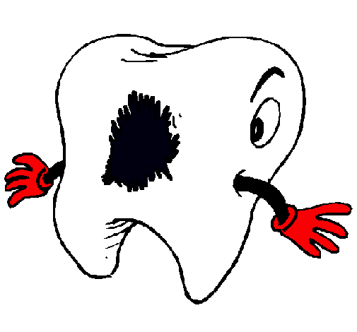 Dibujo de Muela con caries pintado por Juguetes en Dibujos.net el ... Dibujo de Muela con caries pintado por Juguetes en Dibujos.net el ...