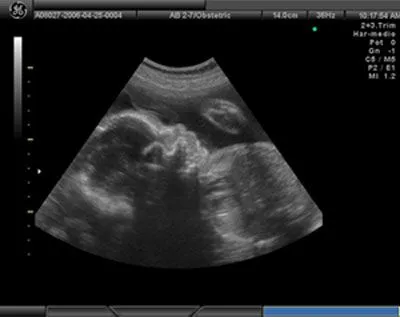 La doble vida de Miranda