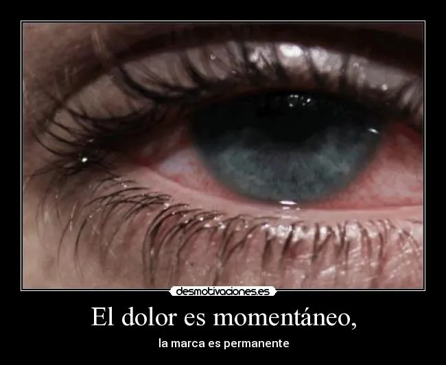 El dolor es momentáneo, | Desmotivaciones