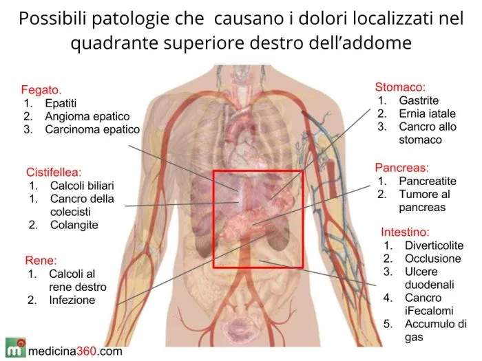 Dolori addominali a destra, sinistra o al basso ventre: cause e ...