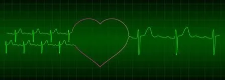 ecg-partir-de-dos-corazones- ...