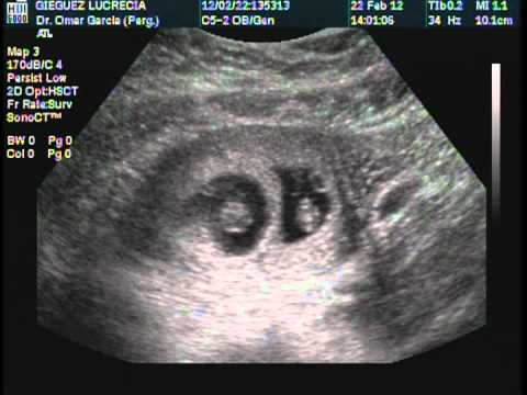 Primer eco de los mellis - YouTube