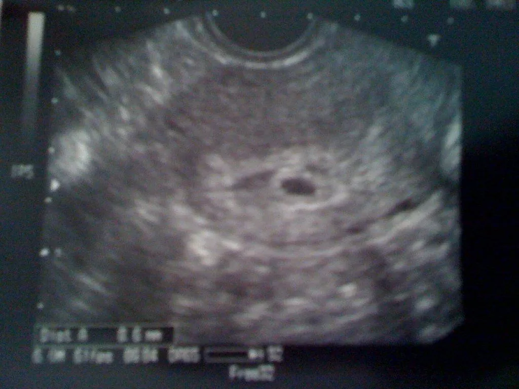 eco 12 semanas (3) | Tener un bebé es facilisimo.