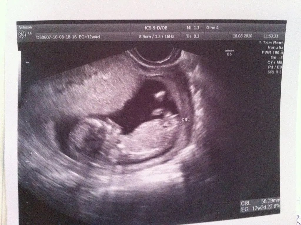 eco 6 semanas (5) | Tener un bebé es facilisimo.