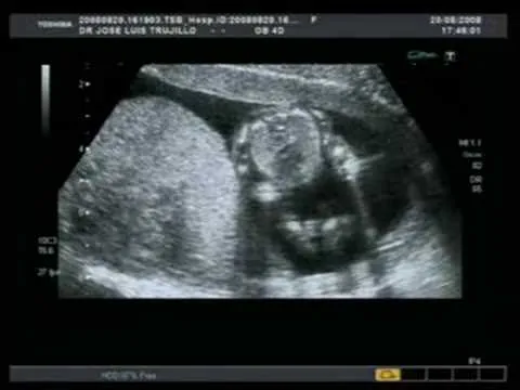 hqdefault.jpg hqdefault.jpg