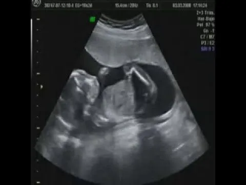 ECOGRAFIA 4D 16 SEMANAS MI NIÑA LA MAS DESEADA ECOGRAFIA 4D 16 SEMANAS MI NIÑA LA MAS DESEADA