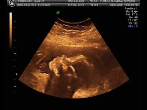 Ecografia 23 semanas Magdalena - YouTube
