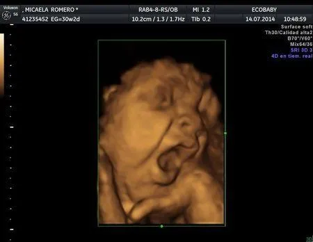 Ecografia 3D y 4D - ❅❆☃Bebés de Octubre 2014☃❆❅ - BabyCenter