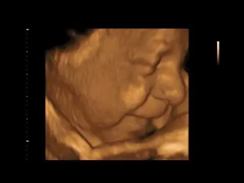 ECOGRAFIA 3D 4D HD EMBARAZO - 28 SEMANAS - DR. RÍOS A Coruña - YouTube ECOGRAFIA 3D 4D HD EMBARAZO - 28 SEMANAS - DR. RÍOS A Coruña - YouTube
