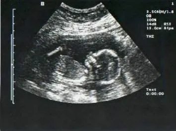 Estrellada: 4 de mayo de 2010 - ilusión donde estas? Estrellada: 4 de mayo de 2010 - ilusión donde estas?