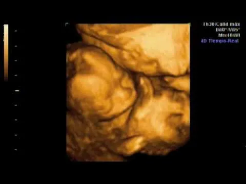 Ecografia 3D de Jacobo a sus 19 semanas - YouTube