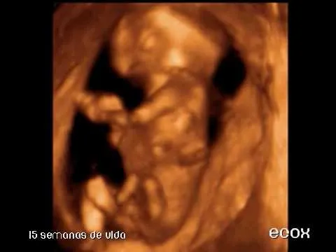 Ecografia 4d con 15 semanas.AVI - YouTube