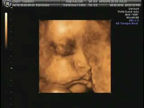 ecografia 4d 8 meses de junior christian tinizaray tigrero - YouTube ecografia 4d 8 meses de junior christian tinizaray tigrero - YouTube