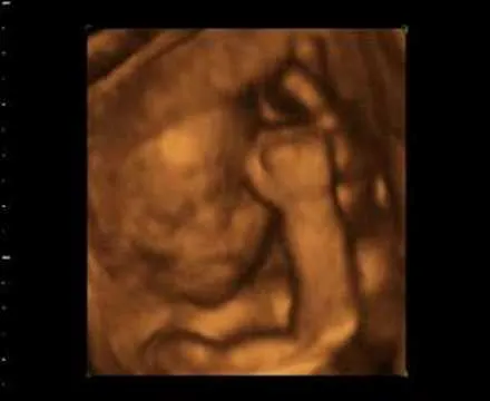 ECOGRAFIA 4D 4 MESES - YouTube