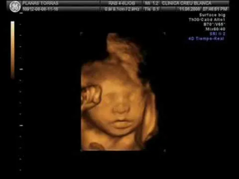 Ecografía 4D Michelle 26 semanas - YouTube