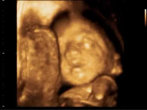 Ecografia 4D de Mirella Dr. Clemente Cuadros Feto 24 semanas - YouTube Ecografia 4D de Mirella Dr. Clemente Cuadros Feto 24 semanas - YouTube