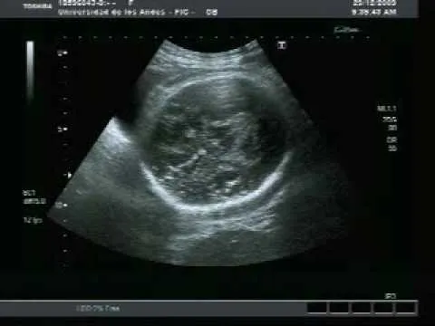 Ecografia de mi bebe de 37 semanas de gestacion - YouTube Ecografia de mi bebe de 37 semanas de gestacion - YouTube