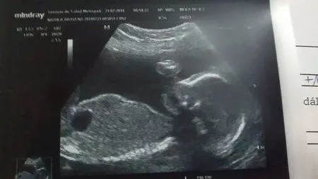 ecografia de mi bebe - ❤ Bebés de Noviembre 2014 ❤ - BabyCenter ecografia de mi bebe - ❤ Bebés de Noviembre 2014 ❤ - BabyCenter