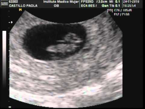 Ecografia bebe de 7 semanas - YouTube