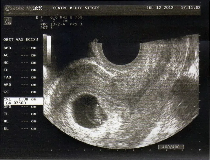 julio | 2012 | Blog de una embarazada