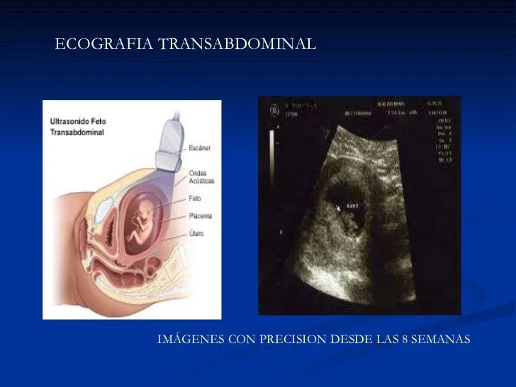 ecografia-del-primer-trimestre ...