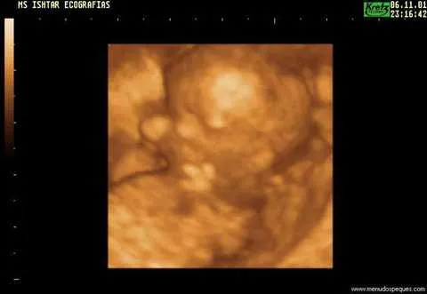 Ecografía con Feto de 14 Semanas - Fotos gratis de Ecografías 3D y ... Ecografía con Feto de 14 Semanas - Fotos gratis de Ecografías 3D y ...