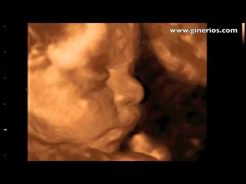 ECOGRAFIA MEDICA 3D 4D HD EMBARAZO 28 semanas - DR. RIOS- LA ... ECOGRAFIA MEDICA 3D 4D HD EMBARAZO 28 semanas - DR. RIOS- LA ...