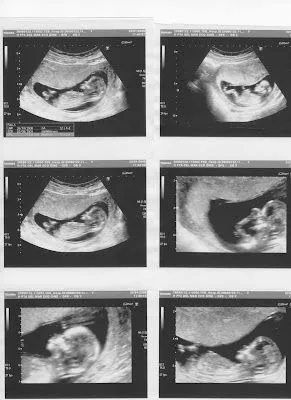 Diario de un embarazo > Diario de un embarazo