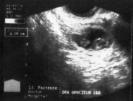 ... desarrollo del bebe, ecografias...toda la informacion del embarazo ... desarrollo del bebe, ecografias...toda la informacion del embarazo