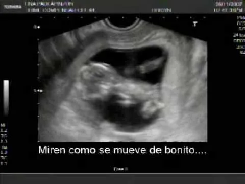 Ecografía de mi Sarita 4 meses de Gestación - YouTube