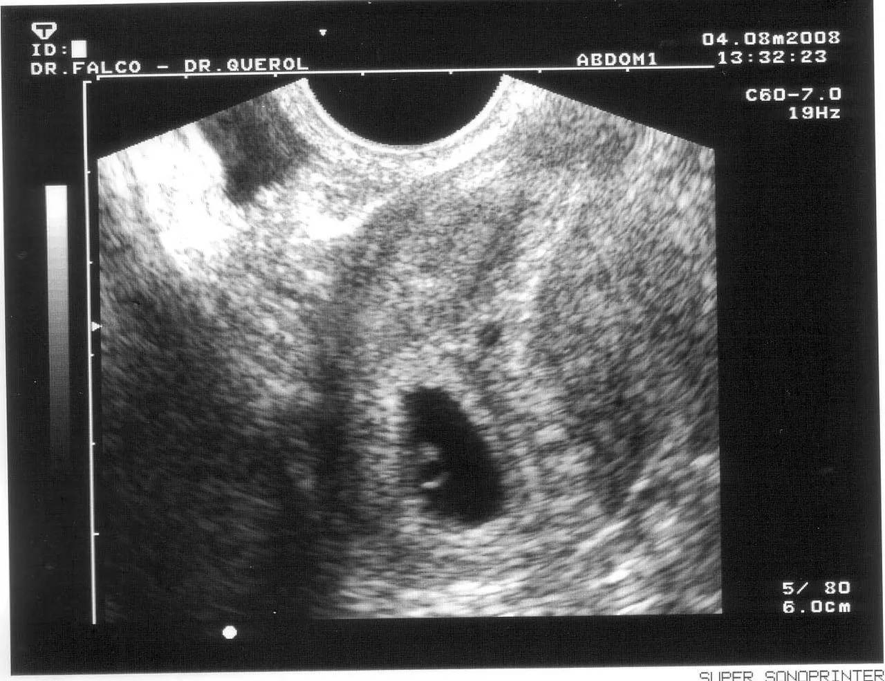 Lydiayesteban’s Weblog Lydiayesteban’s Weblog