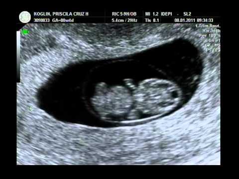 ECOGRAFIA 8 SEMANAS - Youtube Downloader mp3 ECOGRAFIA 8 SEMANAS - Youtube Downloader mp3
