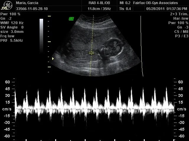 Tercera Ecografía: ¿Será niño o niña? - Paperblog Tercera Ecografía: ¿Será niño o niña? - Paperblog