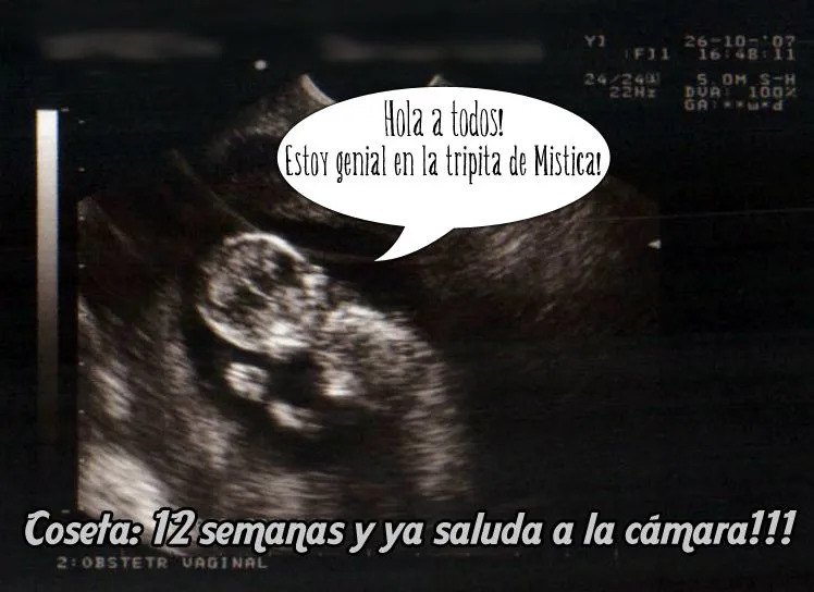 Ecografía | Mi Tripita