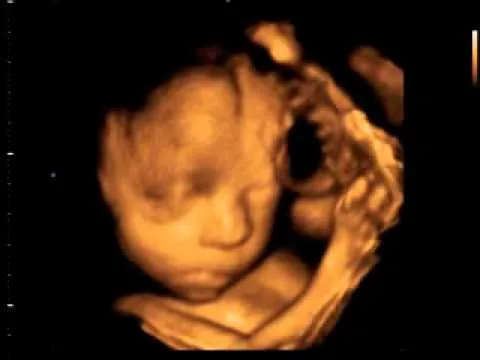 Ecografias 4D Bebés 26 semanas Ecobaby Málaga 952 22 11 29 - YouTube