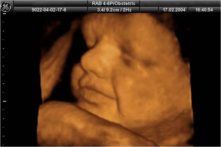 Las ecografías durante el embarazo | Blog de elembarazo.net