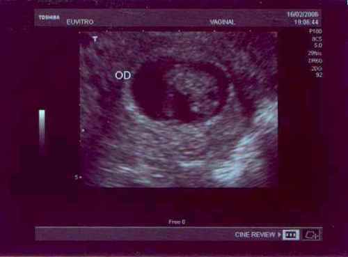 Más ecografías : Las esquinas del círculo