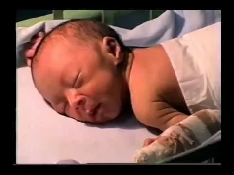 Ectopic Pregnancy 30 weeks Embarazo Ectopico de 30 semanas ... Ectopic Pregnancy 30 weeks Embarazo Ectopico de 30 semanas ...