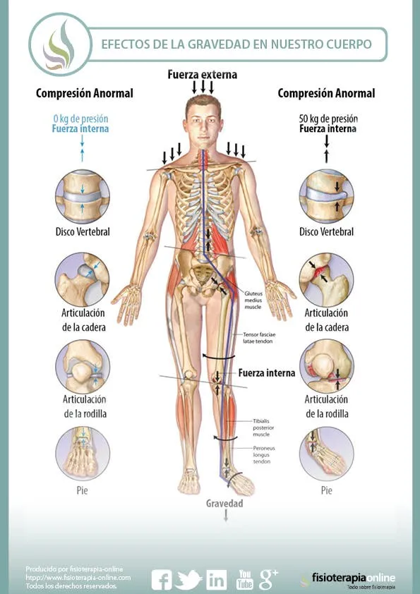 Los efectos de la gravedad sobre nuestro cuerpo y las articulaciones | FisioOnline Los efectos de la gravedad sobre nuestro cuerpo y las articulaciones | FisioOnline