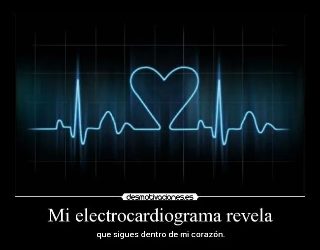 Mi electrocardiograma revela | Desmotivaciones